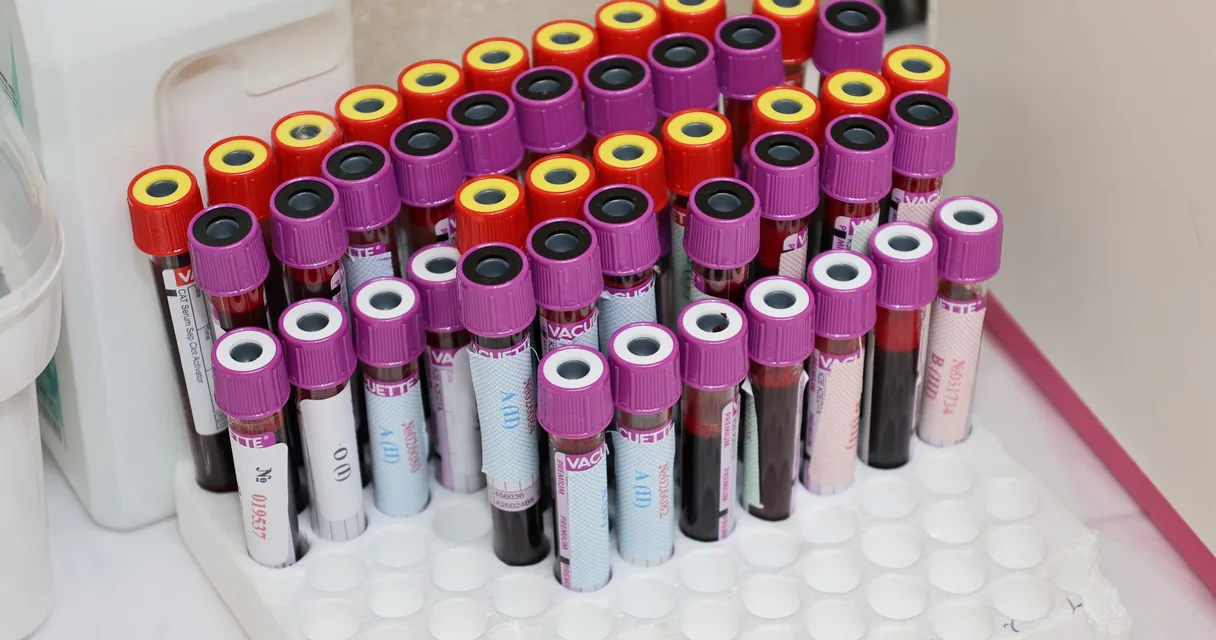 Suporte com tubos de coleta de sangue de tampas coloridas