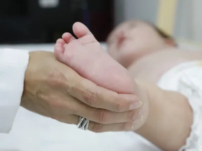 Atraso no teste do pezinho dificulta tratamento da AME no SUS